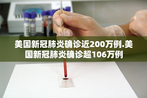 美国新冠肺炎确诊近200万例.美国新冠肺炎确诊超106万例